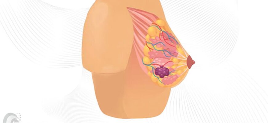 Біль у правому боці: основні причини та способи усунення дискомфорту