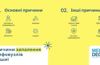 Біль у шиї зліва: причини, діагностика та ефективні методи лікування