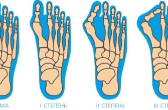 Біль у стопі збоку: причини, діагностика та ефективні способи лікування
