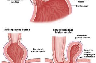 Біль у стравоході при ковтанні: причини, симптоми та лікування
