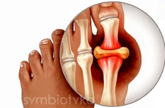 Біль в ногах: причини, діагностика та ефективні методи лікування