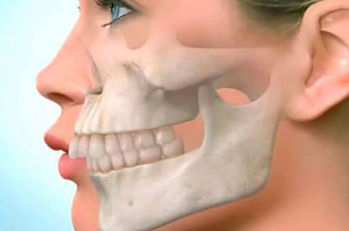 Чому болить щелепа? ▶️ Лікування зубів в Ірпені | MySmile®