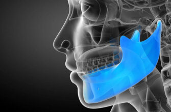 Біль в щелепі з лівого боку: причини, діагностика та лікування