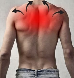 Що таке міофасціальний біль у спині ? - Клініка Печерських / м ...