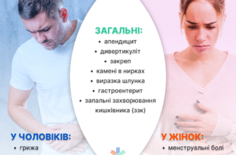 Біль зліва внизу живота у чоловіків: причини та способи лікування