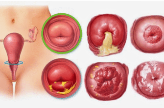 Болі після видалення матки: причини, симптоми та рішення проблеми