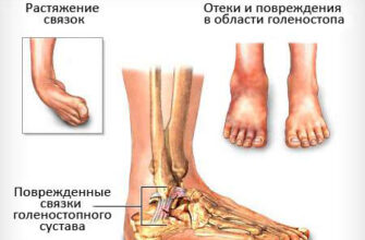 Чому болить нога після операції: основні причини та що з цим робити