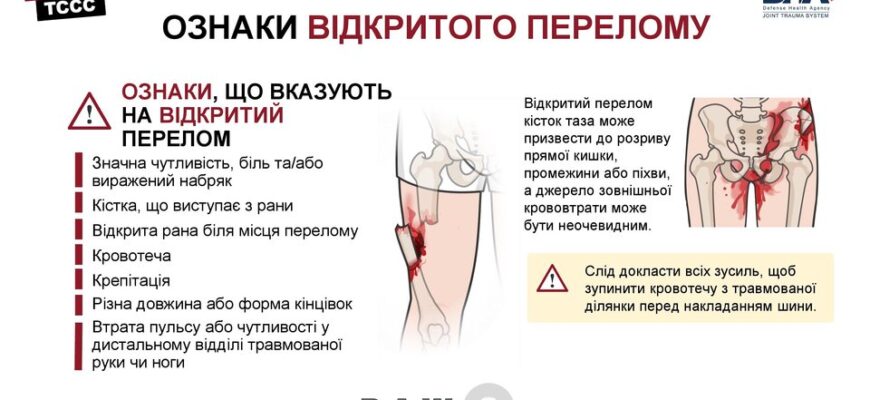 Чому набрякає рука після перелому: основні причини та способи лікування