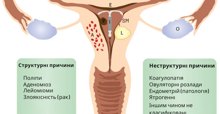 Чому після місячних з’являються кров’яні виділення: причини та пояснення