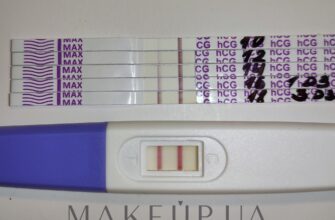 Чому тест не виявляє вагітність після затримки: відповіді з форумів