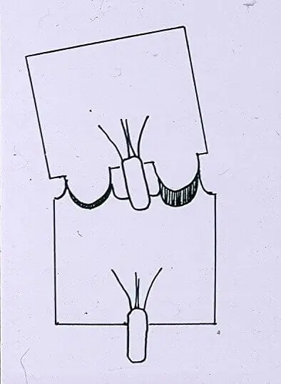 Лікування болю в спині - Діагностика і терапія захворювань хребта