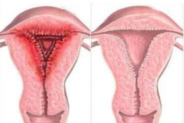 Чорні виділення після місячних: причини та що з ними робити?