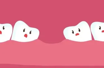 Чутливість зубів після пломбування: причини, лікування та профілактика