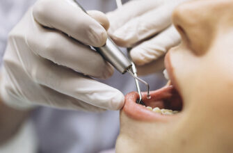 Чутливий зуб після пломбування: причини та ефективні способи лікування
