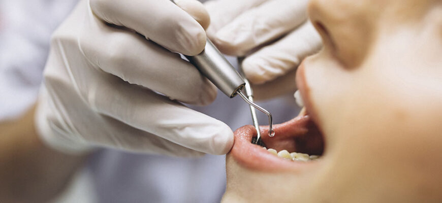Чутливий зуб після пломбування: причини та ефективні способи лікування