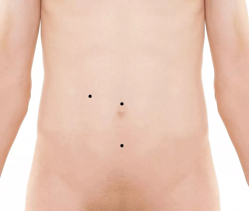 Не ігноруйте біль у животі: як розпізнати апендицит