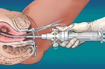 Чи можлива вагітність після медикаментозного аборту: що варто знати?