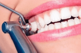 Чи можна їсти після чистки зубів: рекомендації стоматологів