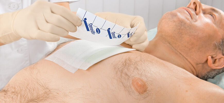 Чи можуть розійтися шви після операції: причини та профілактика