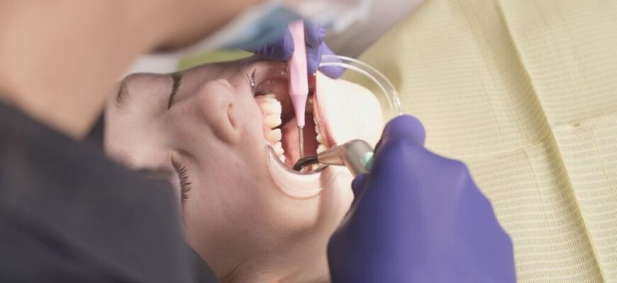 Чи необхідно знімати зубний камінь: ключові аспекти та поради стоматологів