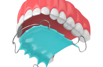 Чи Розходяться Зуби Після Брекетів: Причини та Як Їх Запобігти?