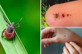 Чи варто приймати антибіотики після укусу кліща: поради лікарів