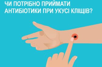 Чи варто приймати антибіотики після укусу кліща: рекомендації лікарів