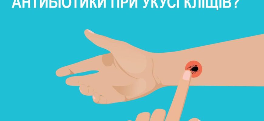 Чи варто приймати антибіотики після укусу кліща: рекомендації лікарів