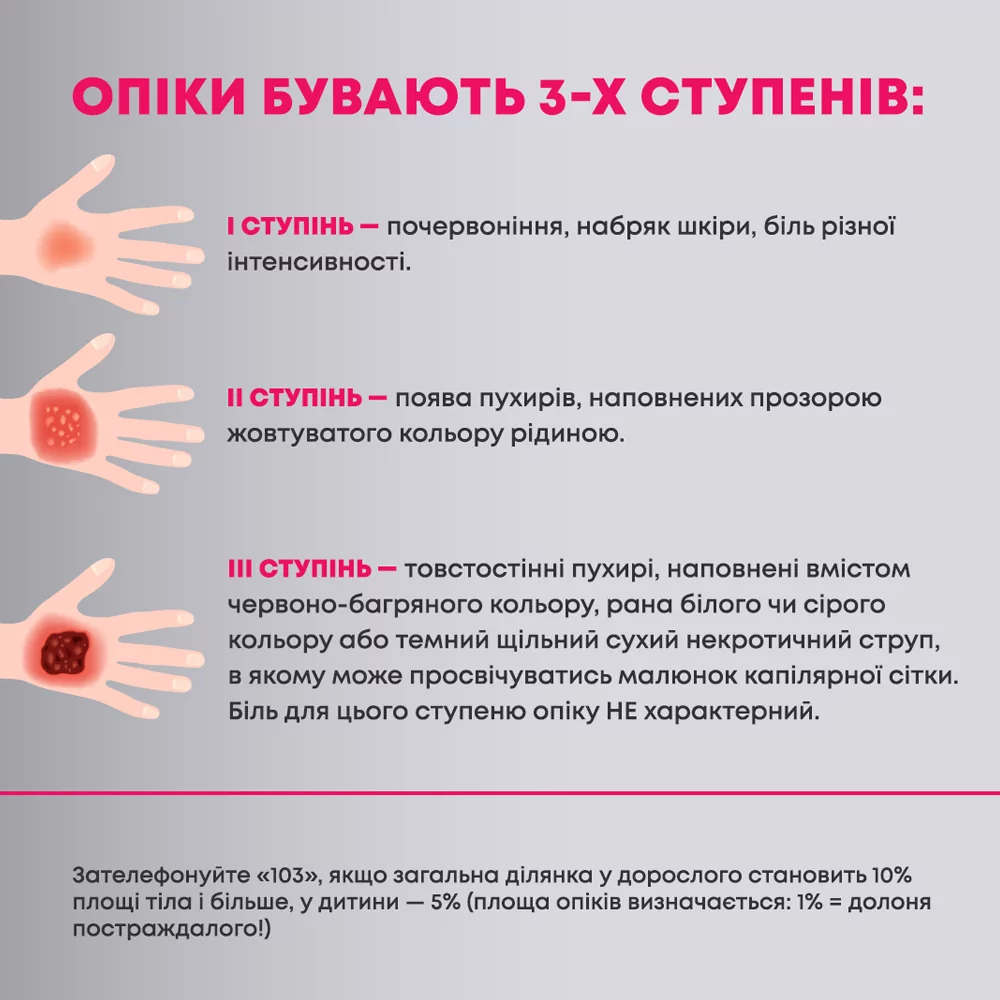 Перша допомога при опіках: що робити в домашніх умовах