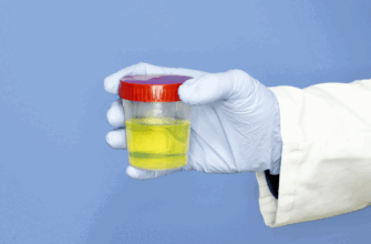 Джерела появи бактерій в сечі: основні причини та профілактика