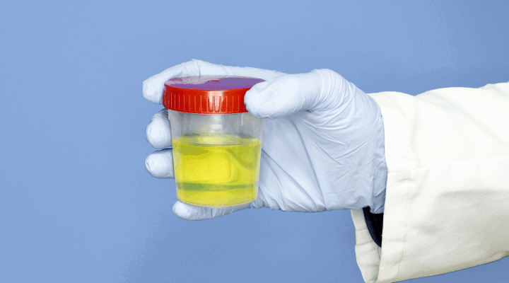 Джерела появи бактерій в сечі: основні причини та профілактика