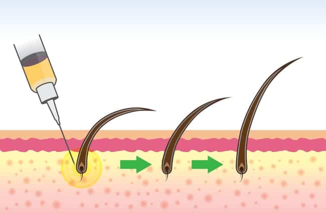 Терапія стовбуровими клітинами в Туреччині: ціни та процедури в ...