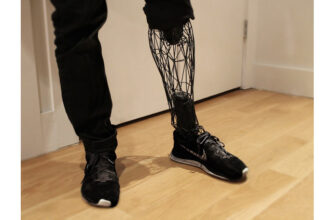 Ефективна реабілітація після ампутації нижніх кінцівок: ключові етапи