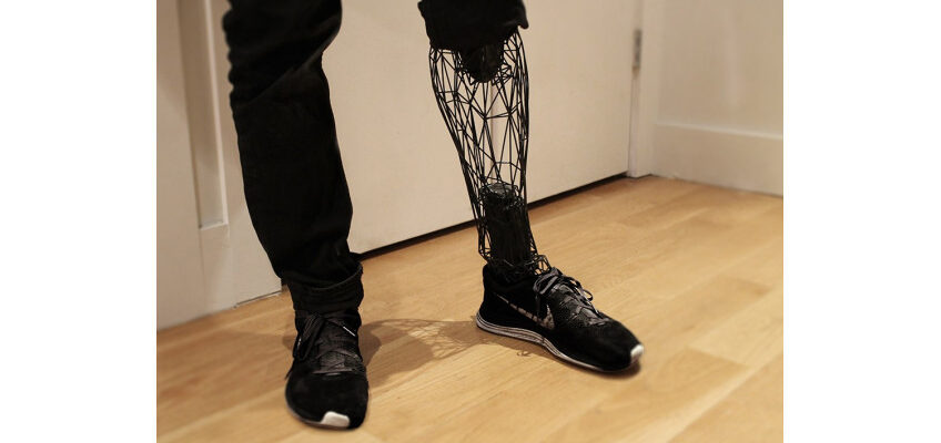 Ефективна реабілітація після ампутації нижніх кінцівок: ключові етапи