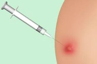 Ефективне лікування абсцесу після уколу: поради та рекомендації