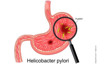 Ефективні ліки для боротьби з хелікобактер пілорі: як обрати найкраще?
