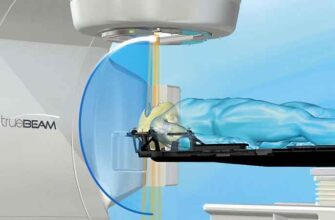 Ефективні ліки після стентування: оптимальний вибір для відновлення