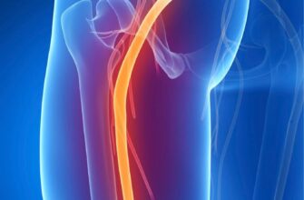 Ефективні ліки від болю при защемленні сідничного нерва: поради та огляд