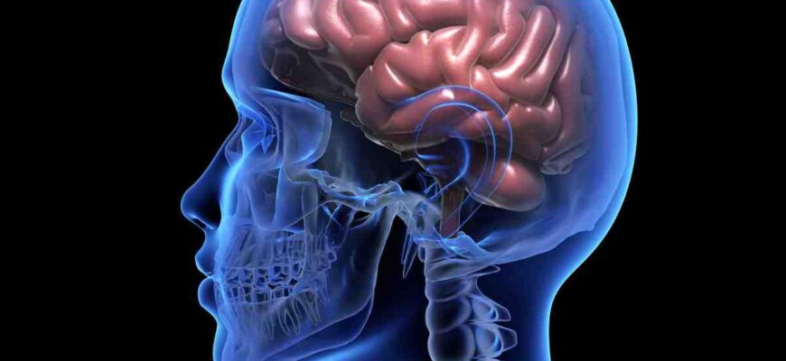 Ефективні методи для швидкого зняття спазму судин головного мозку