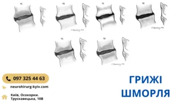 Ефективні методи лікування болю в нижній частині спини: поради експертів