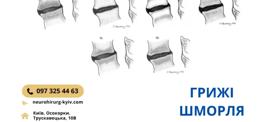 Ефективні методи лікування болю в нижній частині спини: поради експертів
