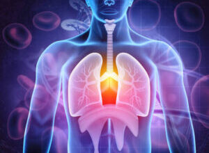 Ефективні методи лікування бронхіту в домашніх умовах: практичні поради