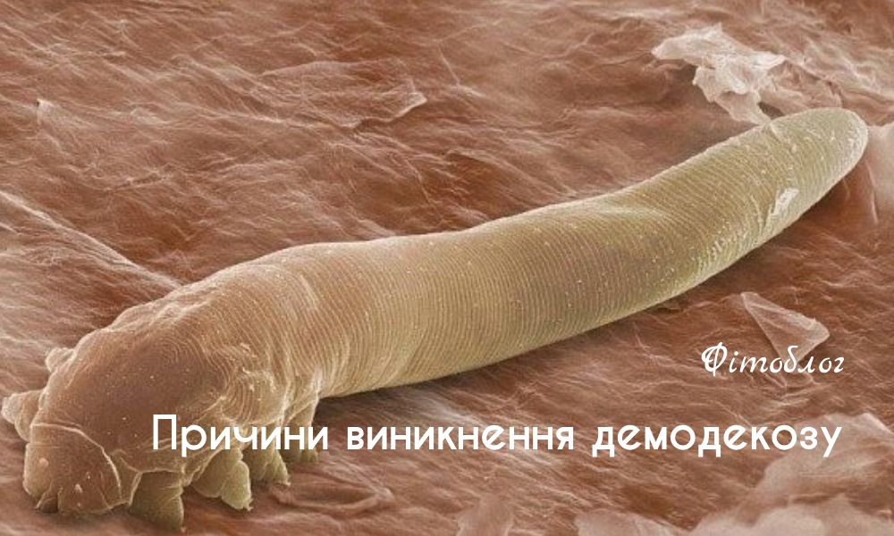 Демодекоз у деталях: симптоми, причини, методи лікування - FitoBlog