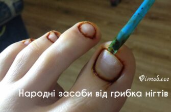 Ефективні методи лікування грибка на нігтях: поради та засоби