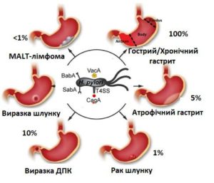 Пробіотики при лікуванні хелікобактера ▶️ Які пробіотики ...