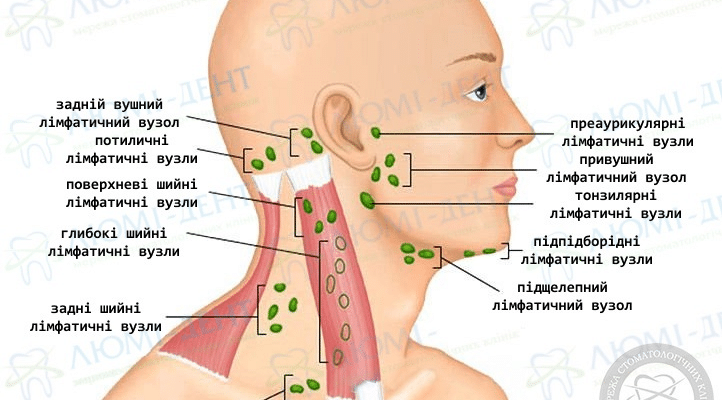 Ефективні методи лікування лімфовузлів на шиї: поради та рекомендації