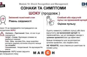 Ефективні методи лікування ниючого болю в ямці: покроковий гайд