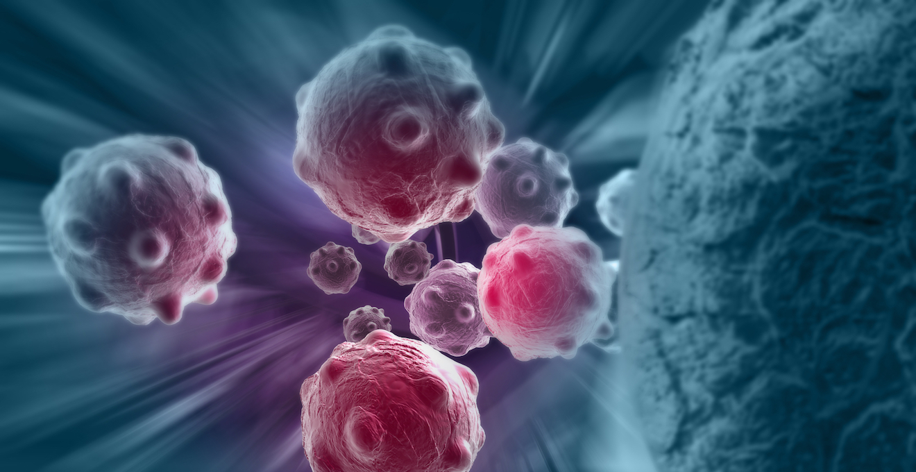 Як вилікувати рак: ефективні методи в Україні та світі ...