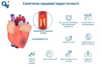 Ефективні методи лікування серцевої недостатності: поради лікарів