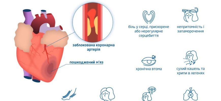 Ефективні методи лікування серцевої недостатності: поради лікарів